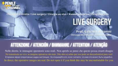 Live Surgery Channel
