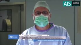 ais-channel-minimally-invasive-penile-prosthesis-implant-12-gen-2019-mp4-1