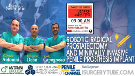 Toglie la Prostata per Tumore ed impianta contestualmente una protesi al Pene con il Robot Da Vinci
